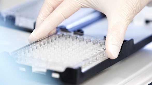 UKR, Uniklinikum Regensburg, Universitätsklinikum Regensburg, Regensburg, Leibniz Institut für Immuntherapie (LIT), CAR-T-Zellen, Krebsmedizin, Krebsforschung, DROP-CAR